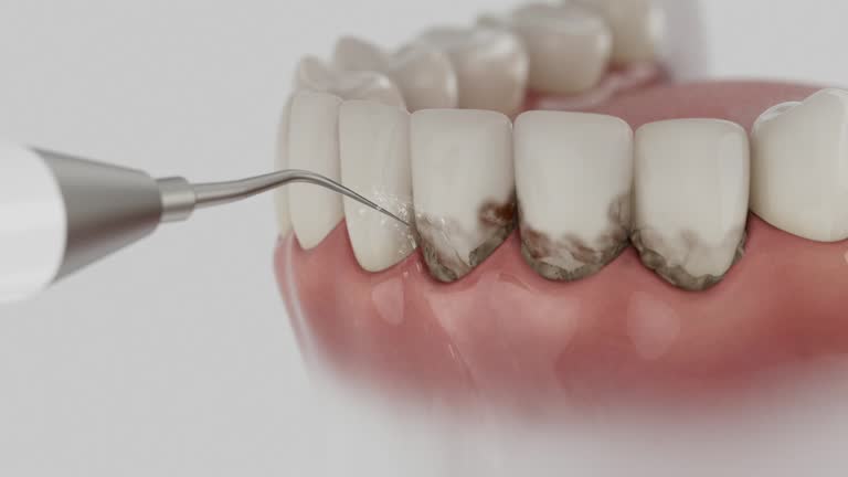 Trusted Root Canal Treatment service in Aldine, TX - Dentist Open Now